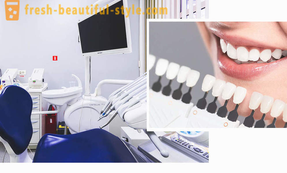 4, ihanteellinen tapa tehdä hampaat