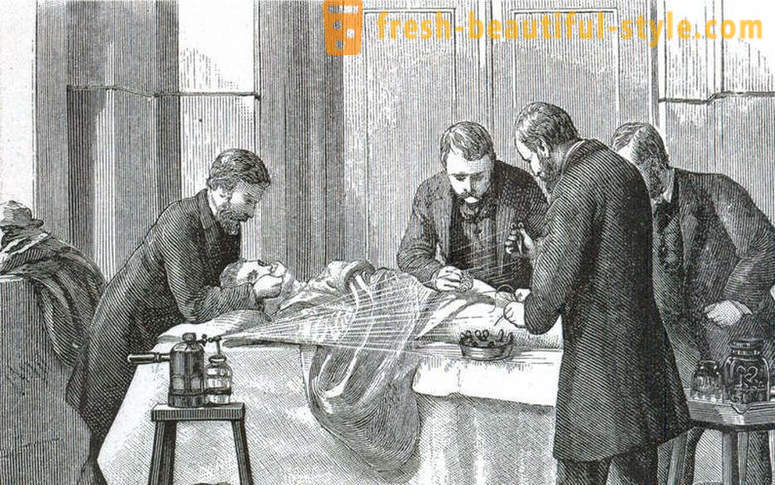 Järkyttävä faktoja Victorian leikkaus
