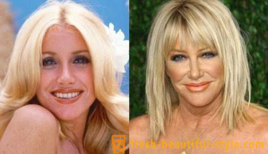 15 kuuluisuuksia, valmis huonosti Botox