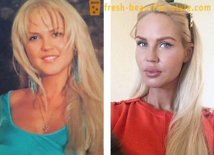 10 Venäjän kauneutta ennen ja jälkeen muovi