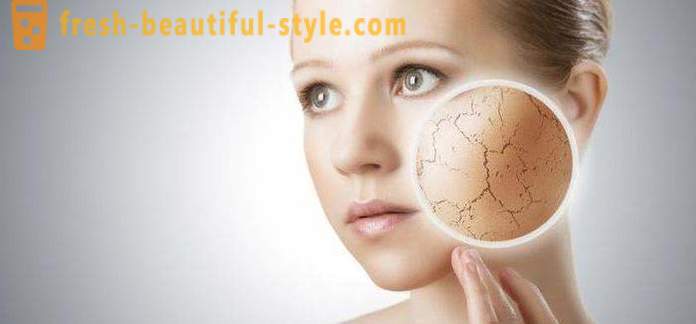 Hilseilevä iho kasvoissa ja käsissä: mahdollisia syitä ja ominaisuudet hoidon