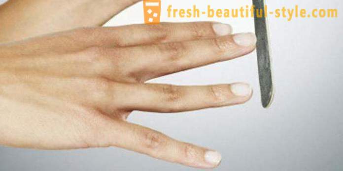 Valkoiset läiskät kynnet sormien: syyt ja hoito