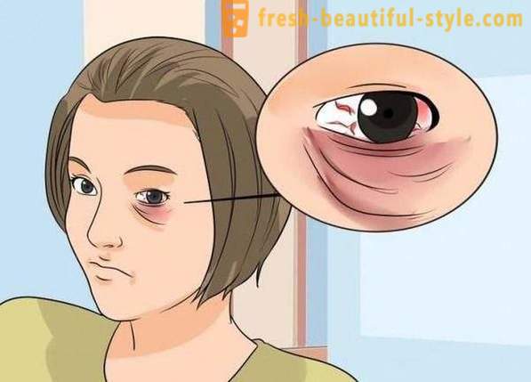 Miten peittää mustan silmän isku: kosmetiikka, erityisesti suosituksia ja