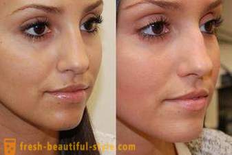 Kuinka vähentää nenä meikkiä? Visuaalisesti vähentää nenän