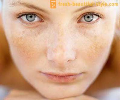 Miksi hilseilevä iho kasvoissa? Ongelma kasvojen ihon