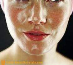 Rasvainen iho kasvot: mitä tehdä ongelman ratkaisemiseksi?